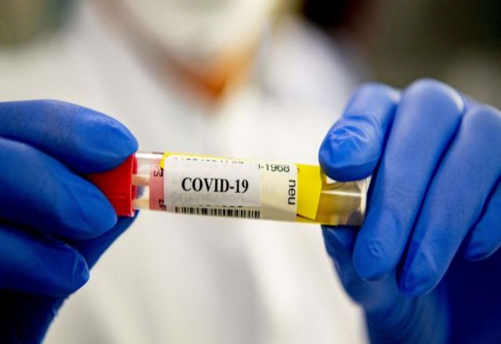 Bilanț coronavirus 30 decembrie: 1.497 cazuri noi și 37 de decese dintre care 1 anterior