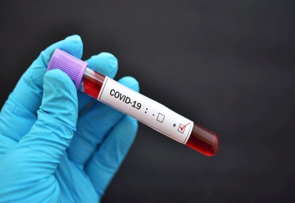 COVID-19: România înregistrează un nou record de decese. Câte cazuri noi sunt în județe