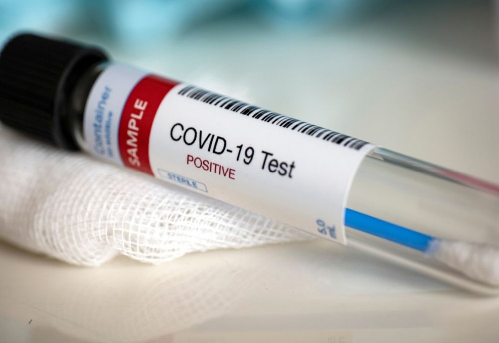 Bilanț coronavirus 25 noiembrie: 2.104 cazuri noi și 212 decese dintre care 35 anterioare