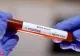 Judeţul Harghita rămâne "blocat" la 19 cazuri de coronavirus. Cifra nu a mai fost actualizată de luni