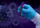 Încă 7 harghiteni infectați; 325 de cazuri noi la nivel național. GCS: „Raportarea este parțială necuprinzând datele de la 12 laboratoare”