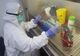 Primul caz confirmat de coronavirus din județul Harghita
