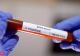 Judeţul Harghita rămâne "blocat" la 19 cazuri de coronavirus. Cifra nu a mai fost actualizată de luni