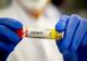 Au fost înregistrate 58 cazuri noi de persoane infectate cu SARS – CoV – 2