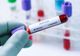 Bilanț coronavirus 23 decembrie: 775 cazuri noi și 81 decese dintre care 44 anterioare
